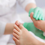 แผลเท้าเบาหวาน อย่ามองข้าม แผลเท้าเบาหวาน