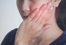 โรคเหงือกอักเสบ หรือ โรคปริทันต์ อาการที่พบได้บ่อยและไม่รุนแรง โรคเหงือกอักเสบ