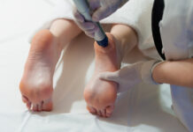 ปวดส้นเท้า อาการยอดฮิตของนักวิ่ง เป็นแล้วมีโอกาสหายขาดหรือไม่ ปวดส้นเท้า