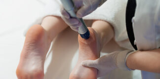 ปวดส้นเท้า อาการยอดฮิตของนักวิ่ง เป็นแล้วมีโอกาสหายขาดหรือไม่ ปวดส้นเท้า