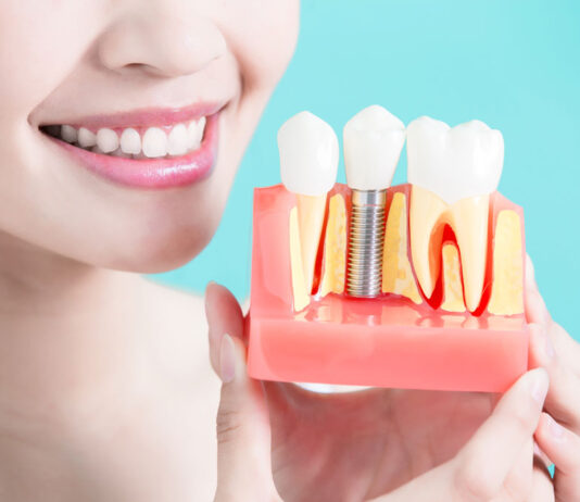 ทันตกรรมรักษารากฟัน