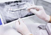 การรักษารากฟัน คืออะไร ? การรักษารากฟัน