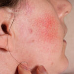 ปานโอตะ คืออะไร ปานโอตะ คืออะไร