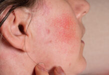 ปานโอตะ คืออะไร ปานโอตะ คืออะไร