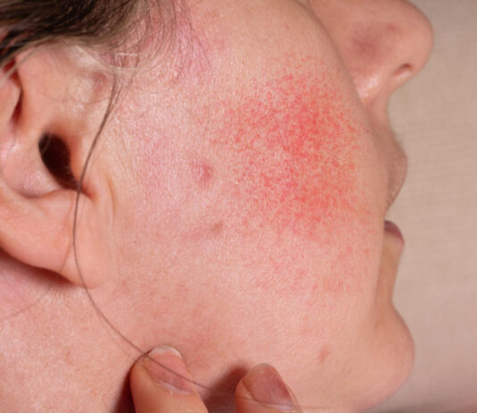 ปานโอตะ คืออะไร ปานโอตะ คืออะไร