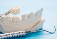 การผ่าตัดปลูกฟันเทียม ต้องเตรียมตัวอะไรบ้าง การผ่าตัดปลูกฟันเทียม ต้องเตรียมตัวอะไรบ้าง