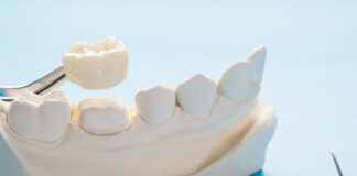 การผ่าตัดปลูกฟันเทียม ต้องเตรียมตัวอะไรบ้าง การผ่าตัดปลูกฟันเทียม ต้องเตรียมตัวอะไรบ้าง