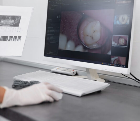พลิกโฉมวงการทันตกรรมด้วย “เทคโนโลยีทันตกรรม CAD/CAM” เทคโนโลยีทันตกรรม CAD/CAM
