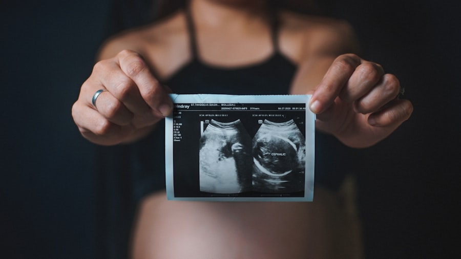 Photo ultrasound tech