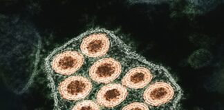 อะดีโนไวรัส: ภัยคุกคามใหม่ในโลกของเรา Photo Adenovirus
