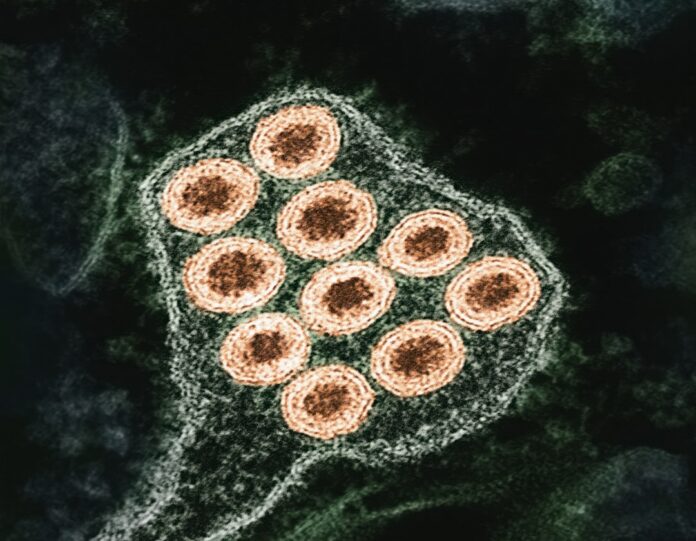 image-4 Photo Adenovirus