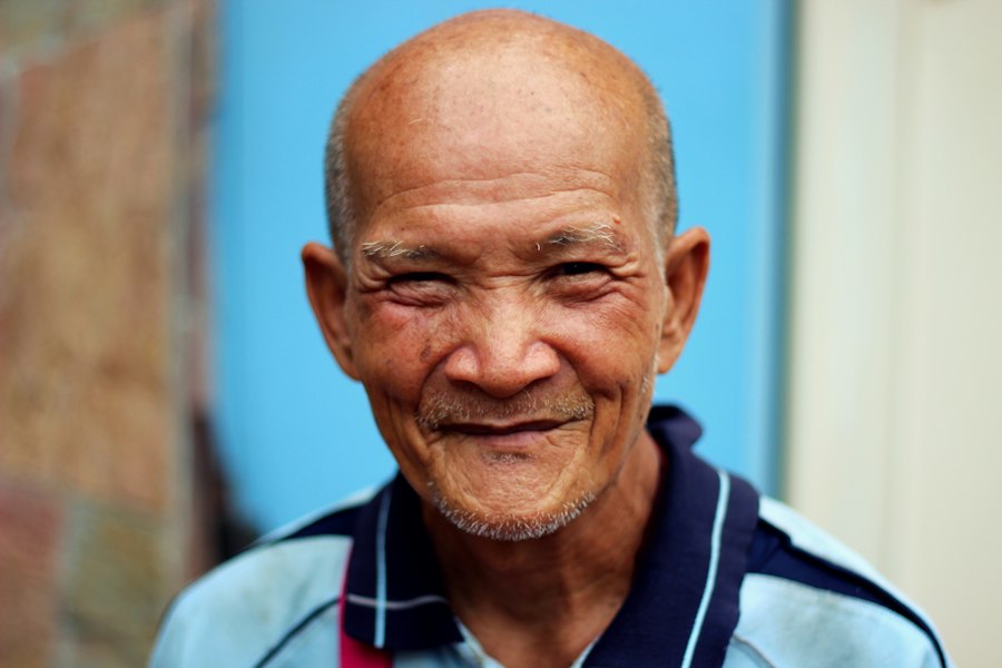 Photo All on 4 dental implants Thailand before after
