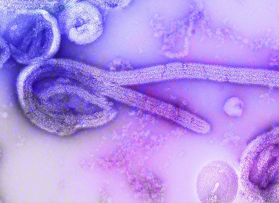 Photo waterborne pathogens